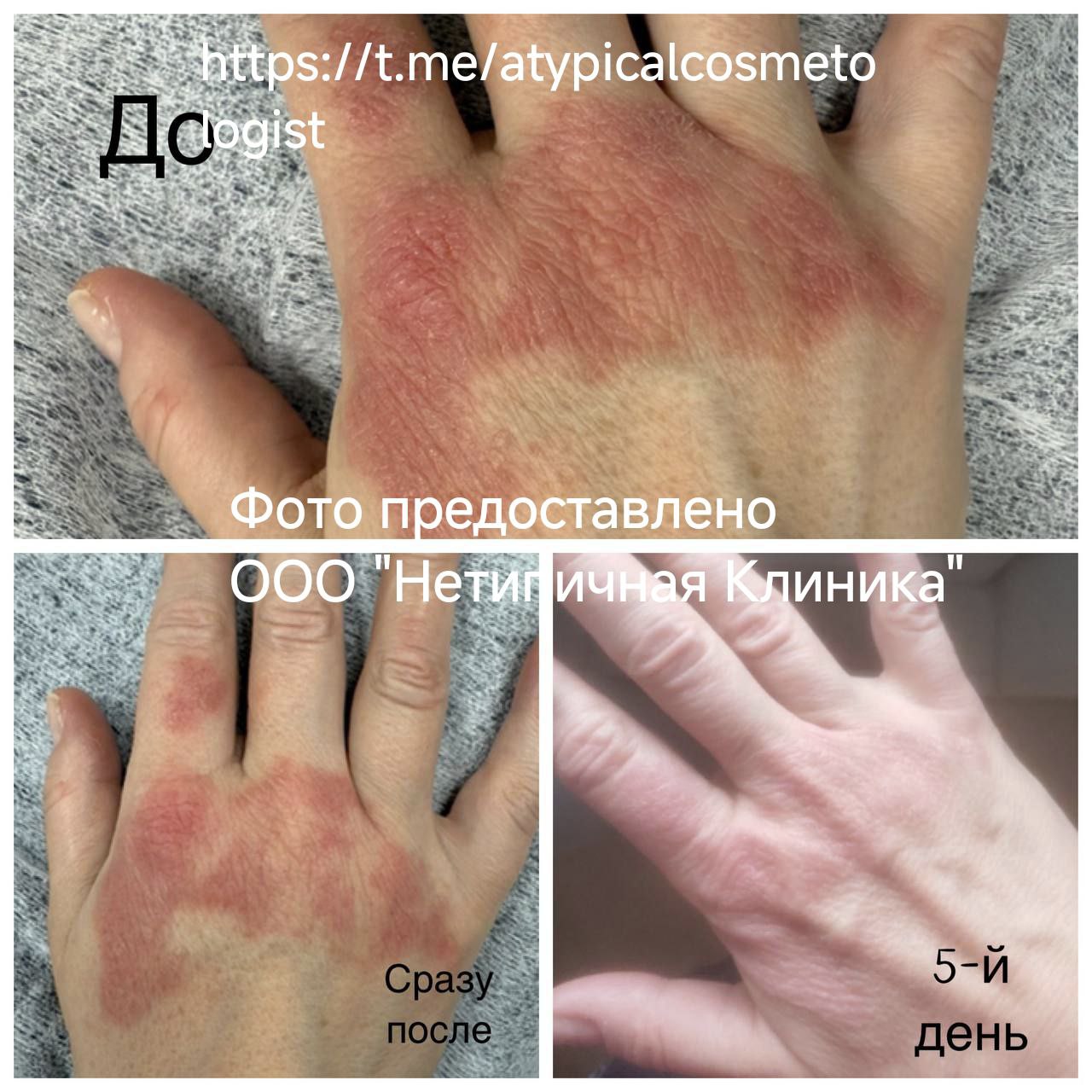 Аппарат для низкоинтенсивной лазерной терапии "SOFTRAY®" Аппарат для низкоинтенсивной лазерной терапии "SOFTRAY®"